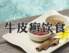 得了银屑病可以喝浓茶吗